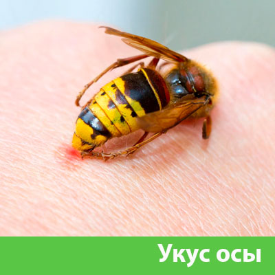 Профессиональное уничтожение ос и шершней в Воронеже