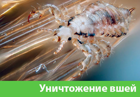 Уничтожение вшей в городе Воронеж